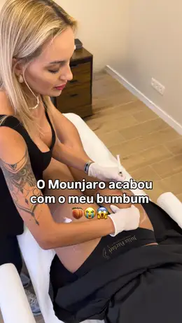 Capa do reel: Tratamento com a Dra. Júlia Furlan