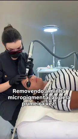 Capa do reel: Removendo micropigmentação